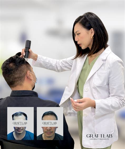 hair transplant cebu|4 Best Clinics for Hair Transplant in Philippines (w/Prices) .